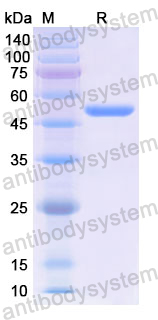 Recombinant Human ACP5 Protein, N-GST