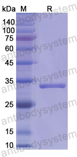 Recombinant Human CD66a/CEACAM1 Protein, N-His