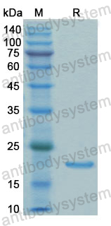 Recombinant Human TPT1 Protein, N-His