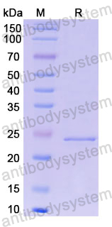 Recombinant Human OSM/Oncostatin-M Protein, N-His