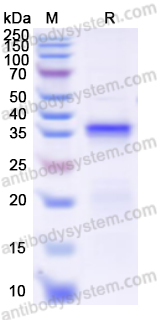 Recombinant Human CD142/F3/TF Protein, N-His