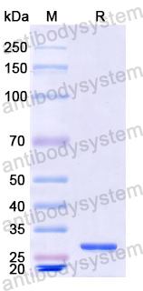 Recombinant Human LCP1 Protein, N-His