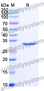 Recombinant Human LCP1 Protein, N-His