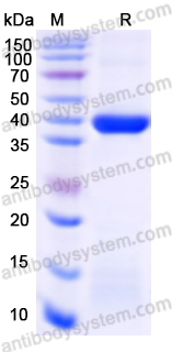 Recombinant Human TNNT1 Protein, N-His