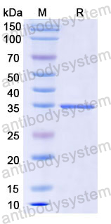 Recombinant Human CD59 Protein, N-GST