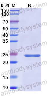 Recombinant Human CD59 Protein, N-His-SUMO