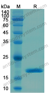 Recombinant Human GFAP Protein, N-His