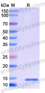 Recombinant Human PRKCSH Protein, N-His
