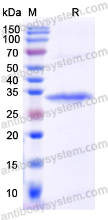 Recombinant Human NID1 Protein, N-His