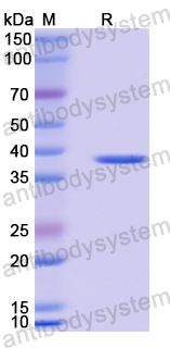 Recombinant Human AKR1A1 Protein, N-His