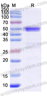 Recombinant Human NCF1 Protein, N-His