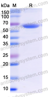 Recombinant Human PKM Protein, N-His