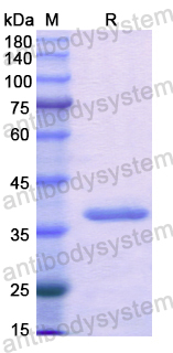 Recombinant Human ACYP2 Protein, N-GST