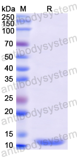 Recombinant Human CCNB1 Protein, N-His