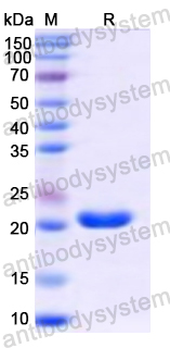 Recombinant Human MYL6B Protein, N-His