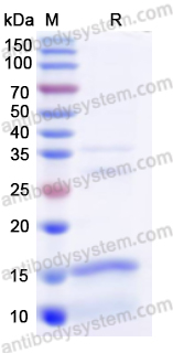 Recombinant Human CD42a/GP9 Protein, N-His