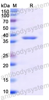 Recombinant Human CD121a/IL1R1 Protein, N-GST