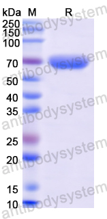 Recombinant Human MMP9 Protein, N-His