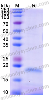 Recombinant Human MMP9 Protein, N-His