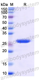 Recombinant Human POU2F1 Protein, N-His