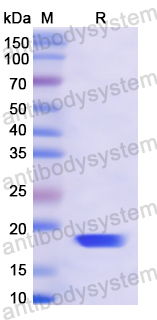 Recombinant Human DARS1 Protein, N-His