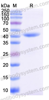 Recombinant Human IDO1 Protein, N-His