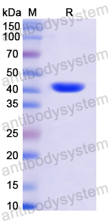 Recombinant Human DAO Protein, N-His