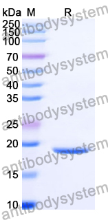 Recombinant Human ETS1 Protein, N-His