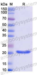 Recombinant Human LIF Protein, N-His