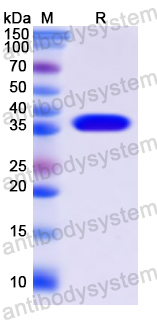 Recombinant Human CPB1 Protein, N-His