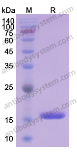 Recombinant Human FABP4 Protein, N-His