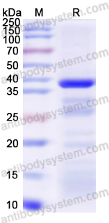 Recombinant Human AKR1B1 Protein, N-His