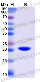 Recombinant Human CD13/ANPEP Protein, N-His