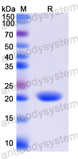 Recombinant Human CPN1 Protein, N-His