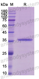 Recombinant Human MYOD1 Protein, N-His