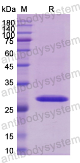 Recombinant Human CD119/IFNGR1 Protein, N-His