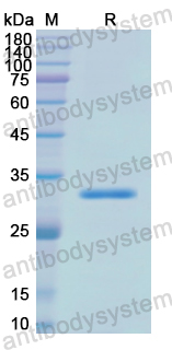 Recombinant Human ARSA Protein, N-His