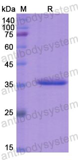 Recombinant Human EZR Protein, N-His