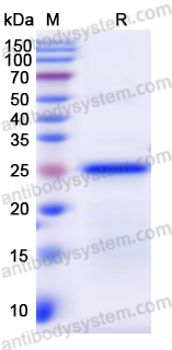 Recombinant Human FOLR1 Protein, N-His