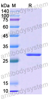 Recombinant Human UCHL3 Protein, N-His