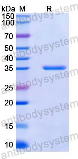 Recombinant Human FOSL2 Protein, N-GST & C-His