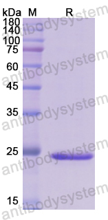 Recombinant Human ELN Protein, N-His