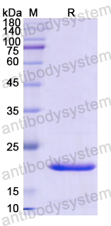 Recombinant Human CD116/CSF2RA Protein, N-His