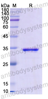 Recombinant Human CD46 Protein, N-His