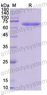 Recombinant Human CYP11B1 Protein, N-GST