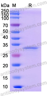 Recombinant Human NQO1 Protein, N-His