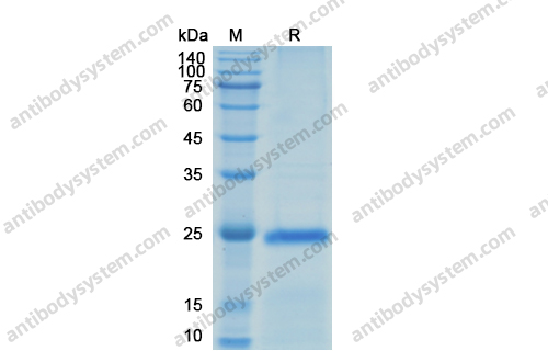 Recombinant Human VEGFA Protein, C-His