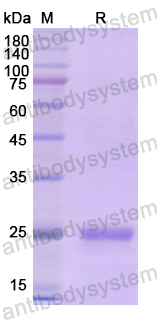 Recombinant Human DSP Protein, N-His