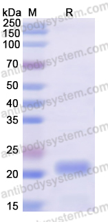 Recombinant Human TIMP2 Protein, N-His