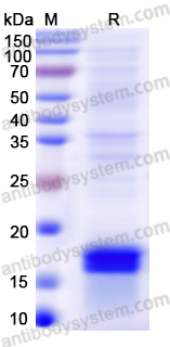Recombinant Human ALOX15 Protein, N-His